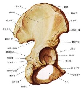 股骨头坏死的高危人群
